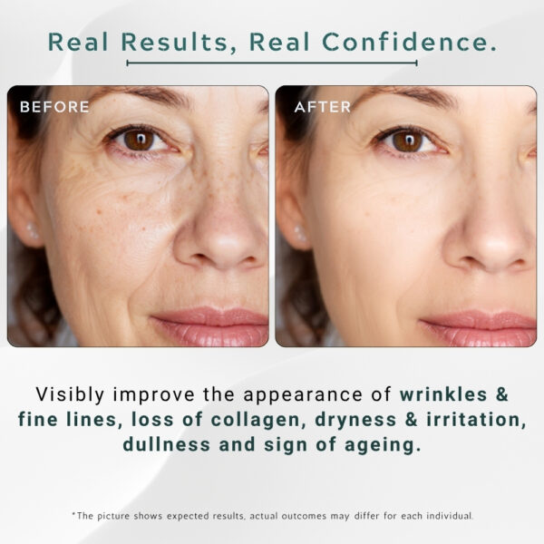 Retinol + Hyaluronic Acid Serum Supreme – 30ml / 1 fl.oz - Image 5