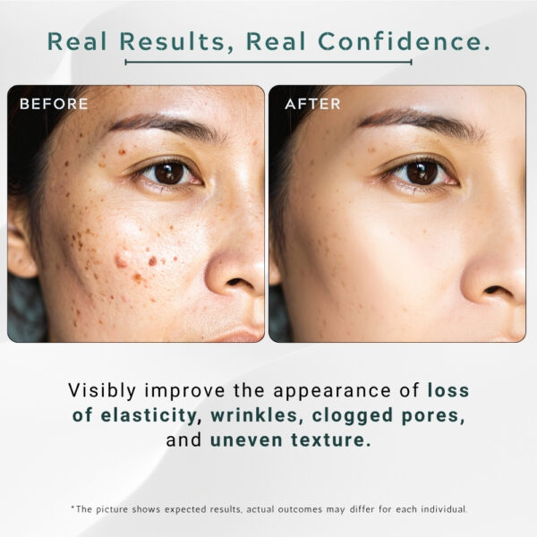 Squalene + Hyaluronic Acid Serum Supreme - 30ml / 1 fl.oz - Image 5