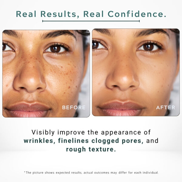 23% Vitamin C + Retinol Serum | Anti-Aging, Glow Boost, Fine Line Repair - 30ml / 1 fl.oz - Image 5