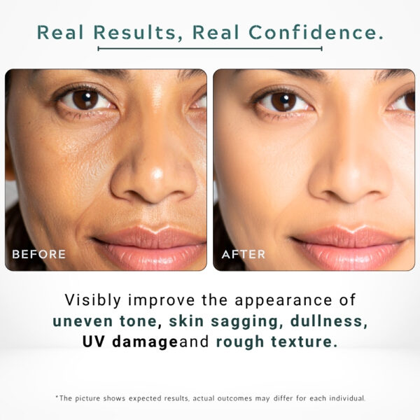 Vitamin C Face Oil | Brightening, Glow Booster, Dark Spot Corrector - 30ml / 1 fl.oz - Image 5