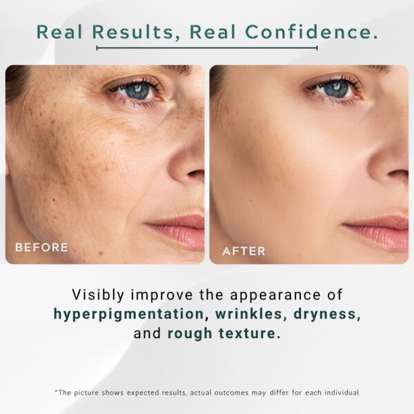 20% Vitamin C + Niacinamide Serum Supreme - 30ml / 1 fl.oz - Image 6