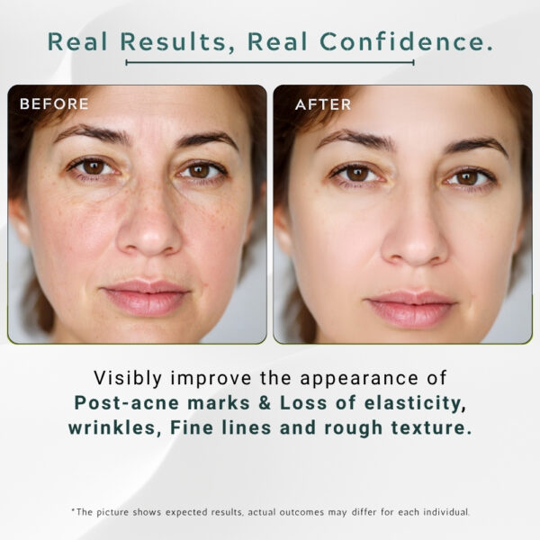 Hyaluronic Acid + Alpha Arbutin Serum Supreme – 30ml / 1 fl.oz - Image 5